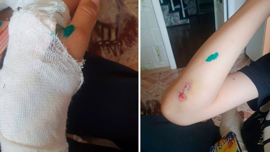 В Башкирии отказали в возбуждении уголовного дела после падения ребенка из окна санатория