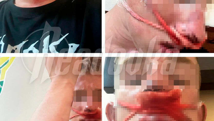 На Сахалине толпа подростков закидала парня булыжниками и ограбила