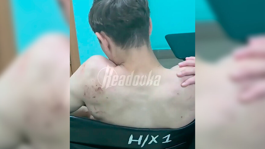 В Башкирии трое мужчин устроили расправу над парнем из-за зеркала мопеда