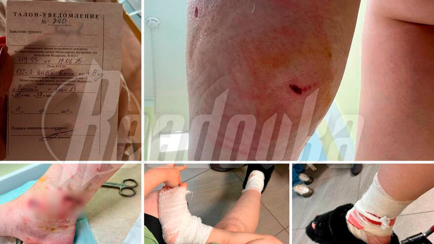 Во Владивостоке отец хулигана натравил бультерьера на мать с ребенком в подъезде