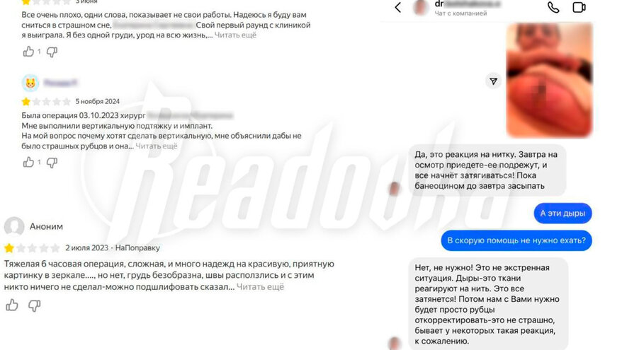 Пациентка челябинской клиники получила некроз тканей после маммопластики. 18+